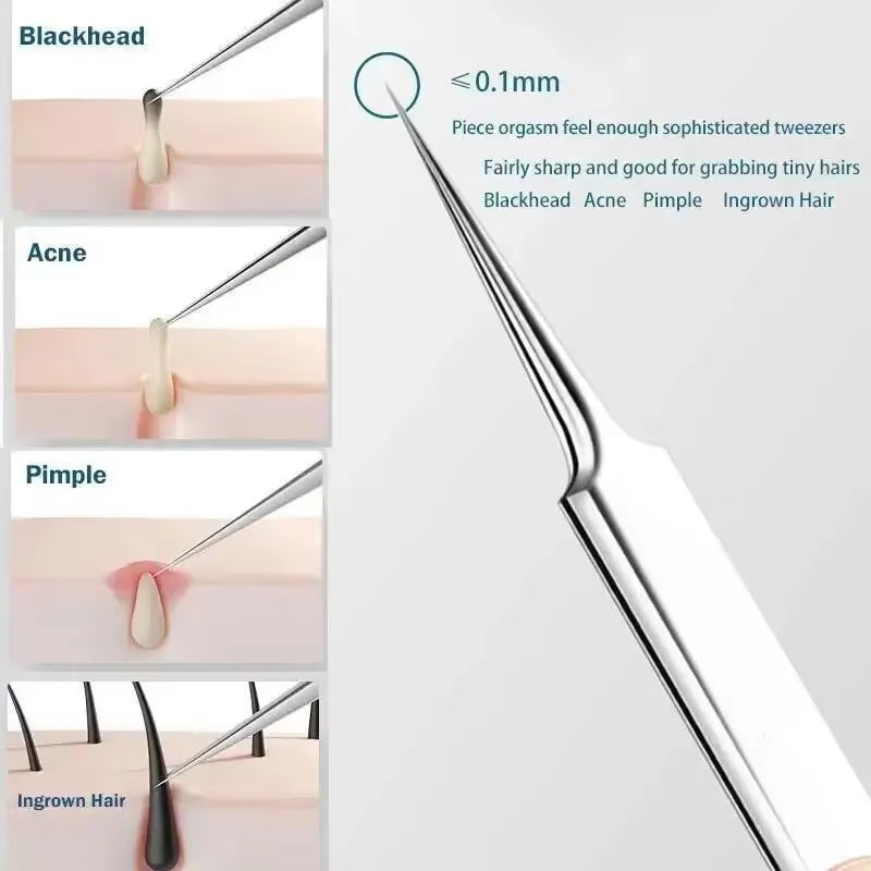11Pcs Ingrown Hair Tweezers & Acne Blackhead Removal Needles