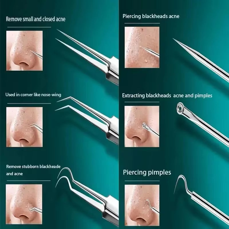 11Pcs Ingrown Hair Tweezers & Acne Blackhead Removal Needles