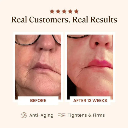 Plasma Skin Perfector - Sale