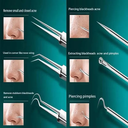 11Pcs Ingrown Hair Tweezers & Acne Blackhead Removal Needles 